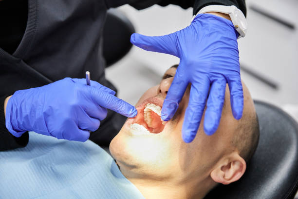 Best Emergency Dentist for Knocked-Out Tooth in Muncy, PA